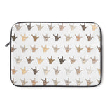 Tiny Hands Laptop Sleeve
